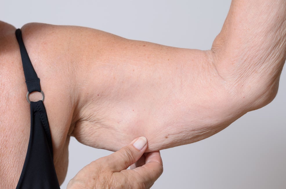 Elderly Woman Pinching Her Arm